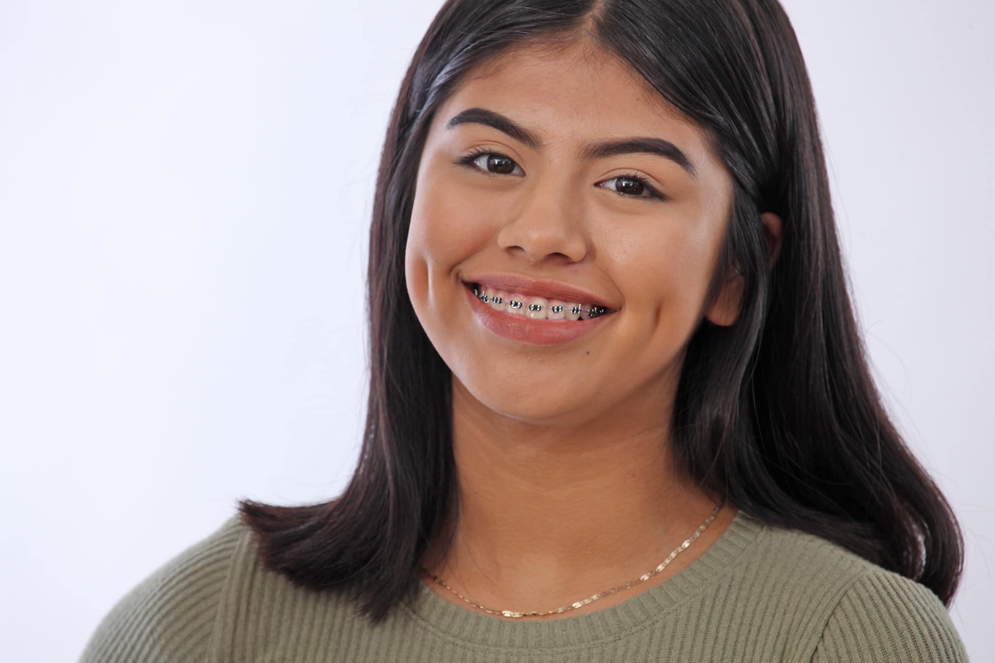 Are Braces Worth the Time, Pain and Money? Somos Dental Downtown Phoenix