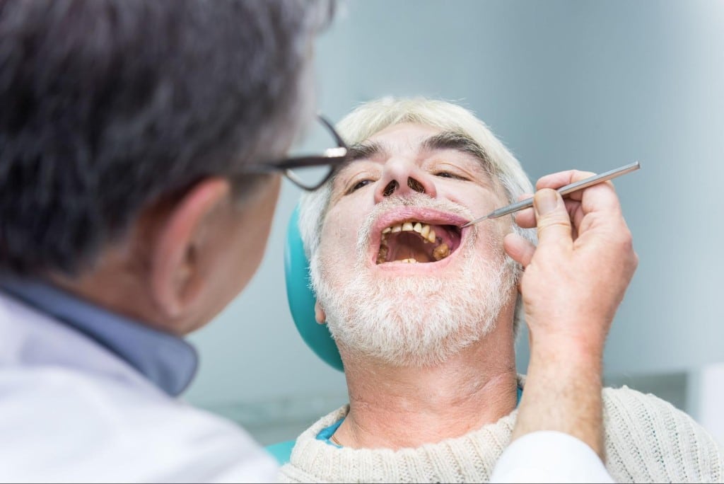 Types of dental caries and treatments